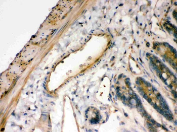 IKB alpha/NFKBIA Rabbit Polyclonal Antibody