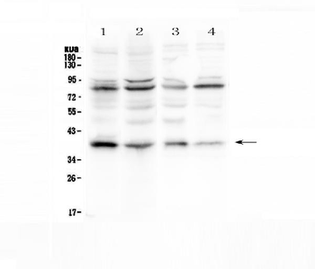 IKB alpha/NFKBIA Rabbit Polyclonal Antibody