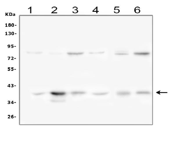 IKB alpha/NFKBIA Rabbit Polyclonal Antibody