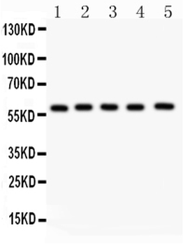 NR5A2/LRH1 Rabbit Polyclonal Antibody