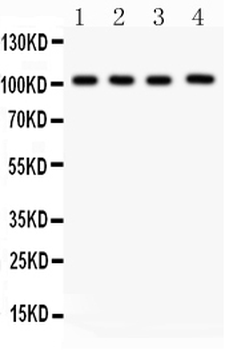 Neuropilin 1/NRP1 Rabbit Polyclonal Antibody