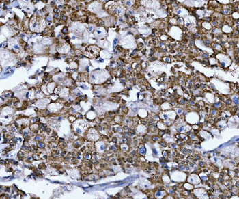 NUMB Rabbit Polyclonal Antibody