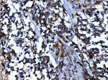 NUMB Rabbit Polyclonal Antibody