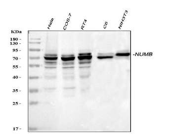 NUMB Rabbit Polyclonal Antibody