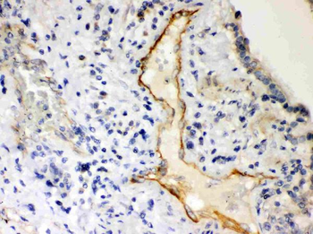 P2X2/P2RX2 Rabbit Polyclonal Antibody
