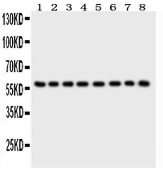 P2X2/P2RX2 Rabbit Polyclonal Antibody