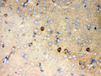 P2X5/P2RX5 Rabbit Polyclonal Antibody