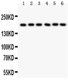 PAPP A/PAPPA Rabbit Polyclonal Antibody