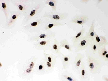 PARP/PARP1 Rabbit Polyclonal Antibody