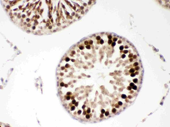 PBK Rabbit Polyclonal Antibody
