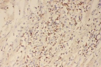 Profilin 1/PFN1 Antibody