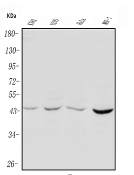 PIM1 Rabbit Polyclonal Antibody