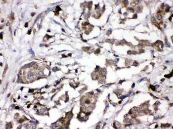 PKC alpha/PRKCA Rabbit Polyclonal Antibody
