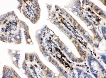 PKC alpha/PRKCA Rabbit Polyclonal Antibody