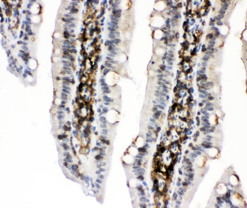 PKC alpha/PRKCA Rabbit Polyclonal Antibody