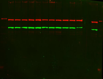 PKC alpha/PRKCA Rabbit Polyclonal Antibody