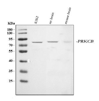 PKC beta 1/PRKCB Rabbit Polyclonal Antibody