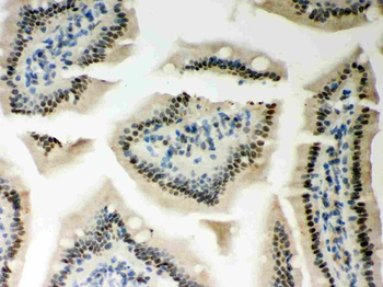 PKC epsilon/PRKCE Rabbit Polyclonal Antibody