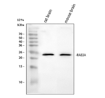 Rab3A Rabbit Polyclonal Antibody