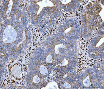 Hsp47/SERPINH1 Antibody