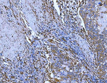 Hsp47/SERPINH1 Antibody