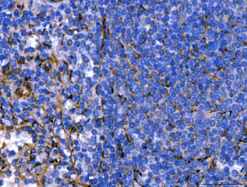 Hsp47/SERPINH1 Antibody