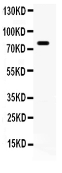 FE65/APBB1 Rabbit Polyclonal Antibody