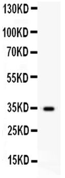 Hepatocyte growth factor HGF Rabbit Polyclonal Antibody