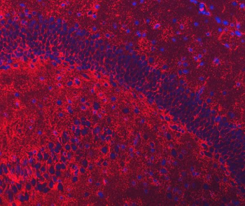 EAAT2/GLT-1/SLC1A2/GLT Rabbit Polyclonal Antibody