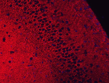 EAAT2/GLT-1/SLC1A2/GLT Rabbit Polyclonal Antibody