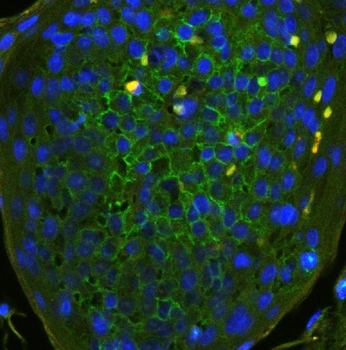 CD44 Rabbit Polyclonal Antibody