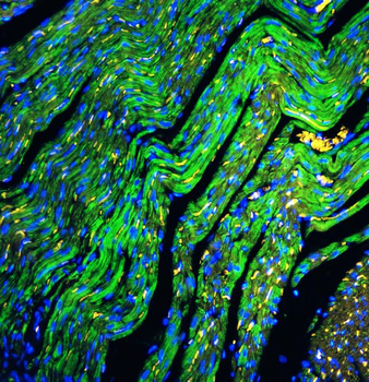 Cytochrome C/CYCS Antibody