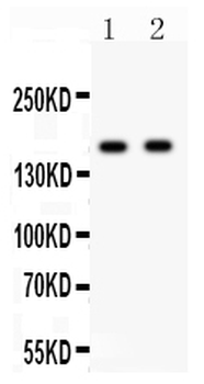 NMDAR2A/GRIN2A Rabbit Polyclonal Antibody