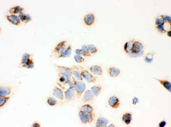 ERAB/HSD17B10 Antibody