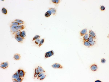 ERAB/HSD17B10 Antibody