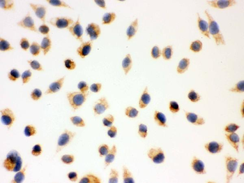 ERAB/HSD17B10 Antibody