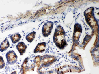 Hsp60/HSPD1 Antibody