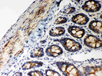 Hsp60/HSPD1 Antibody