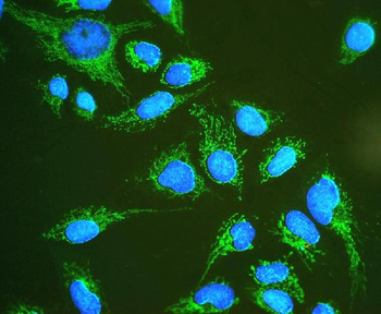 Hsp60/HSPD1 Antibody