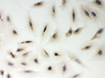 LYRIC/MTDH Rabbit Polyclonal Antibody