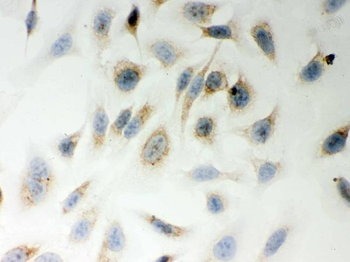 LYRIC/MTDH Rabbit Polyclonal Antibody