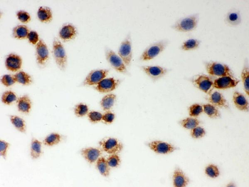 LYRIC/MTDH Rabbit Polyclonal Antibody