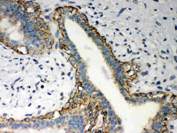 LYRIC/MTDH Rabbit Polyclonal Antibody