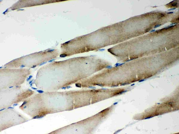 LYRIC/MTDH Rabbit Polyclonal Antibody