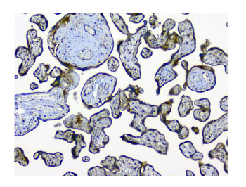 N myc interactor/NMI Antibody