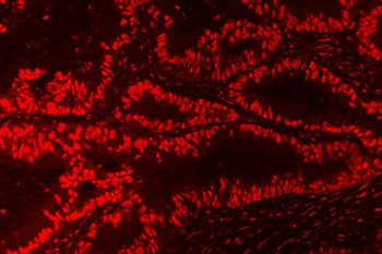 Nucleophosmin/NPM1 Rabbit Polyclonal Antibody