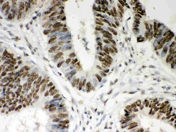 Nucleophosmin/NPM1 Rabbit Polyclonal Antibody