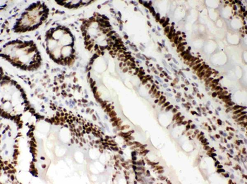 Nucleophosmin/NPM1 Rabbit Polyclonal Antibody