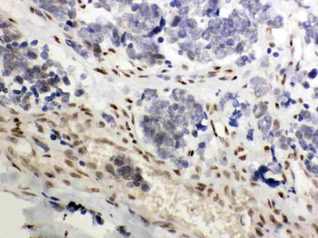 Glucocorticoid Receptor/NR3C1 Rabbit Polyclonal Antibody