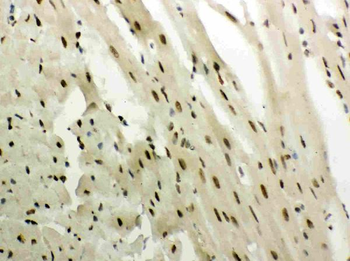 Glucocorticoid Receptor/NR3C1 Rabbit Polyclonal Antibody